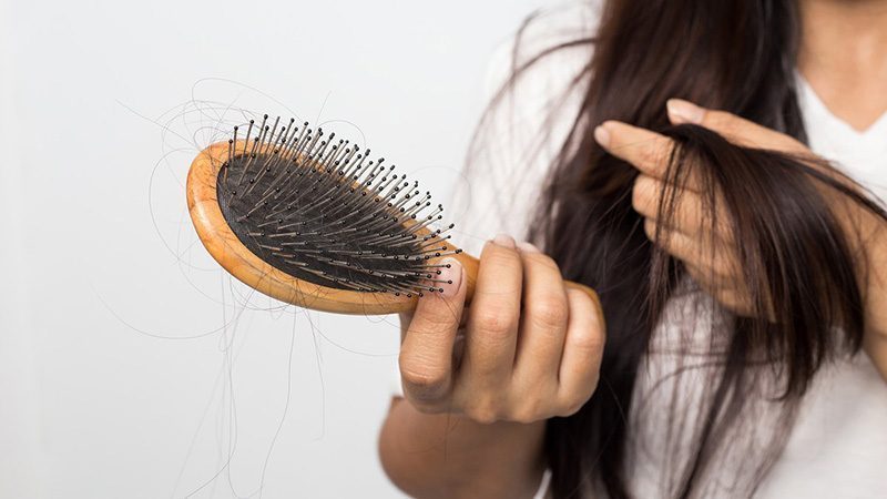 Лечение выпадения волос Киев